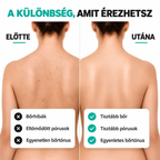 Hámlasztó Testtörölköző